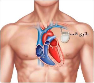 باتری قلب؛ باطری قلب؛ ایمنی جراحی قلب؛ محصولات ضد امواج
